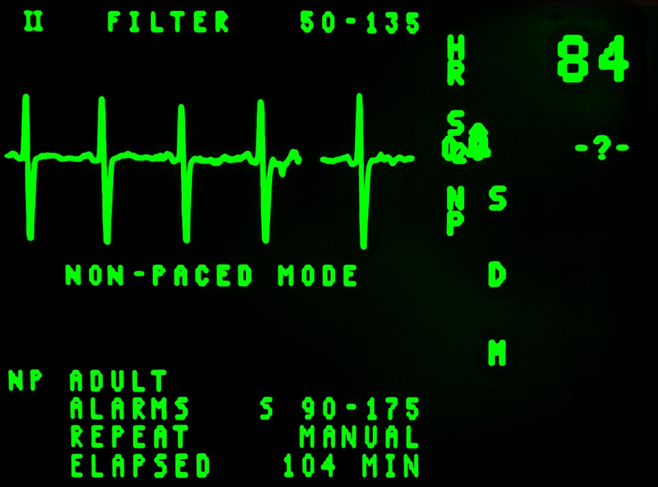 electrocardiogram-16948_960_720